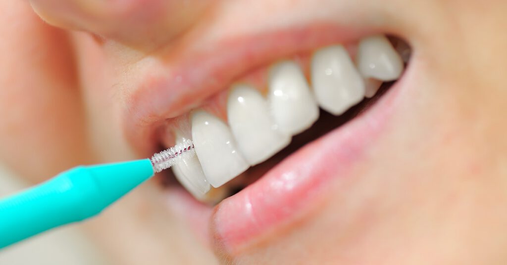 interdental cleaning advice warwickshire