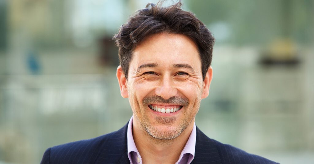Gummy Smile Dental Treatment in Leamington Spa Warwickshire