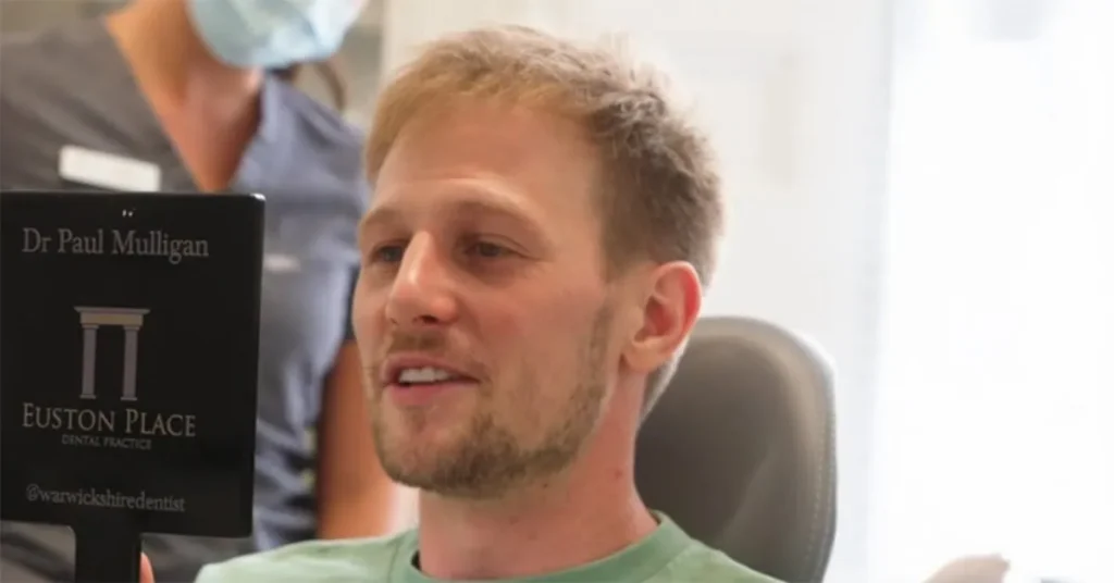 kieran's invisalign journey leamington spa