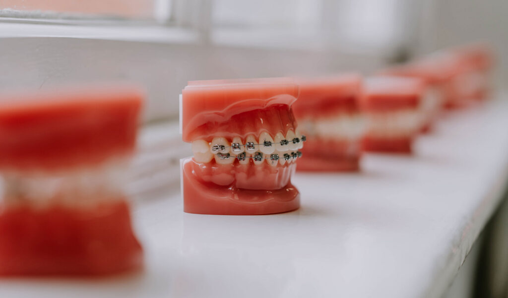 Orthodontics teeth models