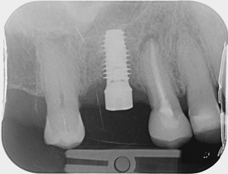 Img cosmeticDentistry 5a