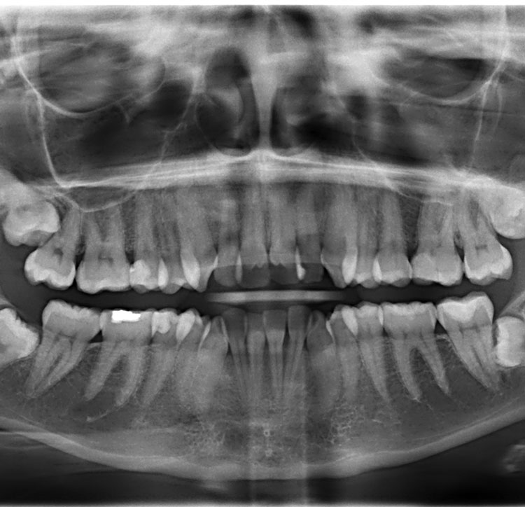 Img generalDentistry